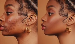 High-End Retouching in Photoshop A Complete Guide – Retouching Academy
